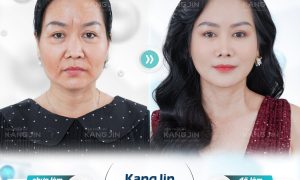 Ảnh 1