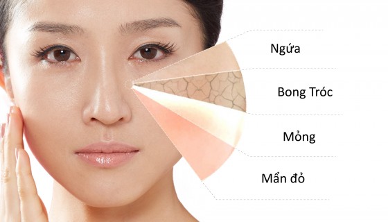Dấu hiệu cho thấy làn da đang bị hư tổn và cần được khắc phục ngay 