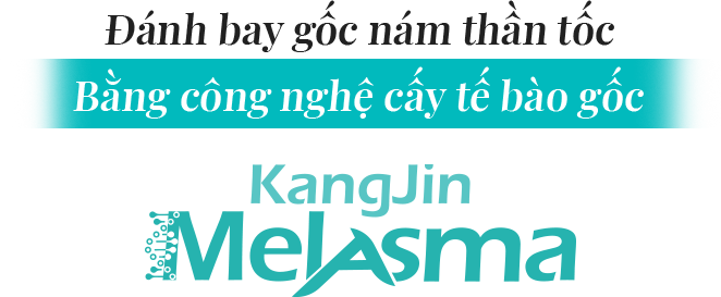 tri-nam-kangjin-melasma-1
