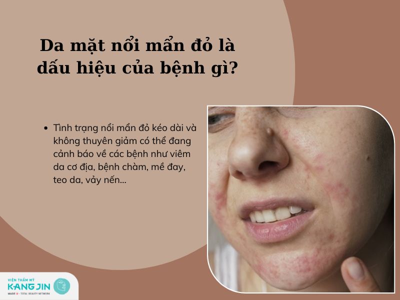 da mặt bị nổi mẩn có liên quan đến những bệnh lý nào