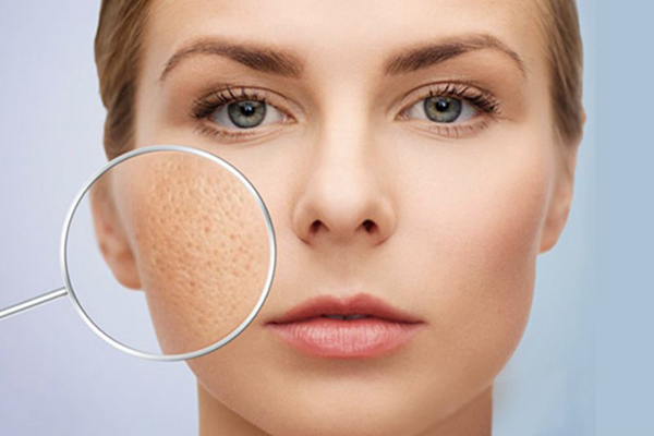 Tái tạo da sau điều trị mụn