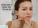 7 Hướng xử lý khi bị sưng mặt vì thuốc bắc tái tạo da