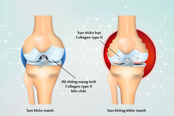 Tác dụng của collagen đối với xương và sụn