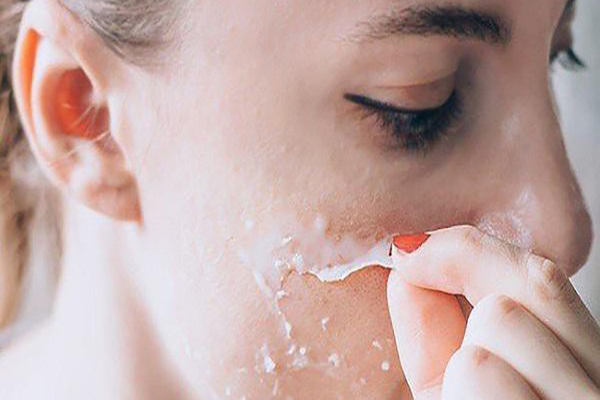 Da có hiện tượng bong tróc và hình thành da mới sau 3 - 5 ngày