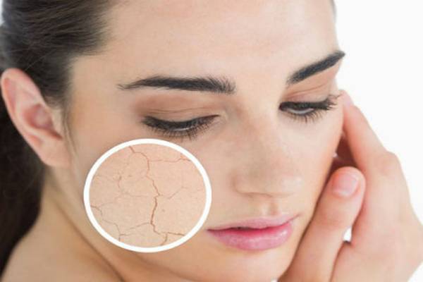 Lỗ chân lông mở rộng để tiết bã nhờn khi da quá khô và thiếu ẩm