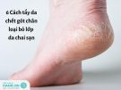 6 Cách tẩy da chết gót chân loại bỏ lớp da chai sạn