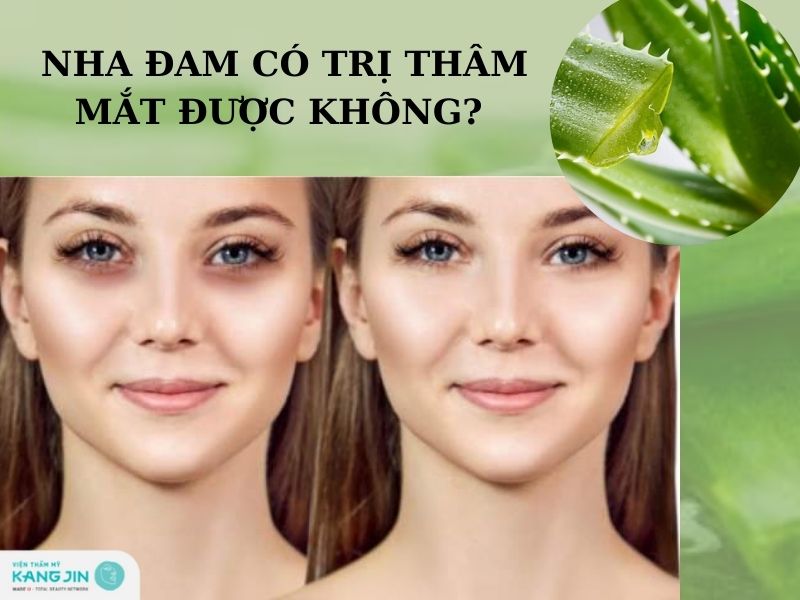 Nha Đam Có Trị Thâm Mắt Không? Bí Quyết Tự Nhiên Hiệu Quả