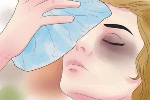 Cách chăm sóc sau khi bóc mỡ bọng mắt