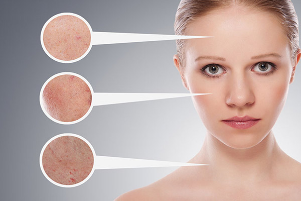 Da mặt có nhiều hư tổn sau liệu trình điều trị mụn, nám,...