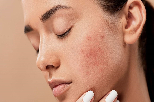 Làn da cần đắp mặt nạ thải độc