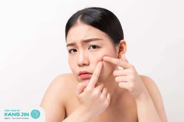 Điều trị mụn đúng cách tránh gây tổn thương da và để lại sẹo