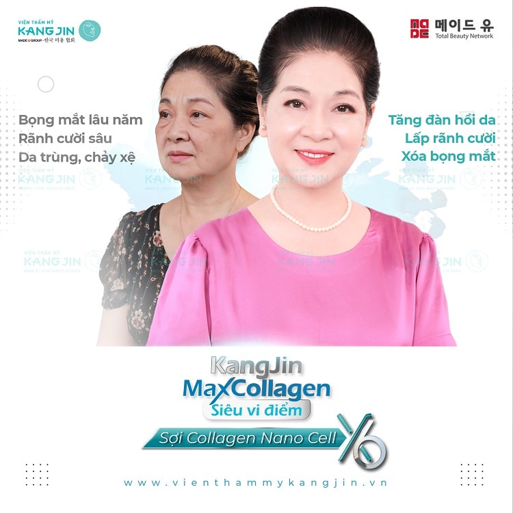 Diễn viên Minh Phương đã trẻ ngay 10 tuổi sau 60p sử dụng liệu pháp Siêu Vi Điểm Diễn viên Minh Phương đã trẻ ngay 10 tuổi sau 60p sử dụng liệu pháp Siêu Vi Điểm