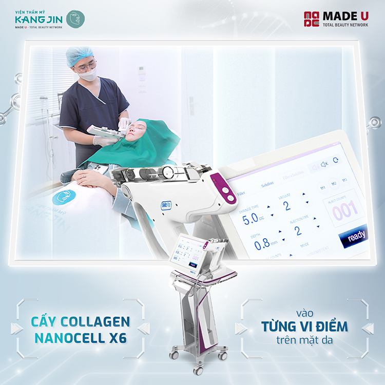 Cấy sợi Collagen Nano Cell X6 vào từng vi điểm để trẻ hóa
