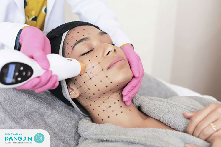 Công nghệ Thermage phù hợp trẻ hóa cho nhiều vùng da khác nhau