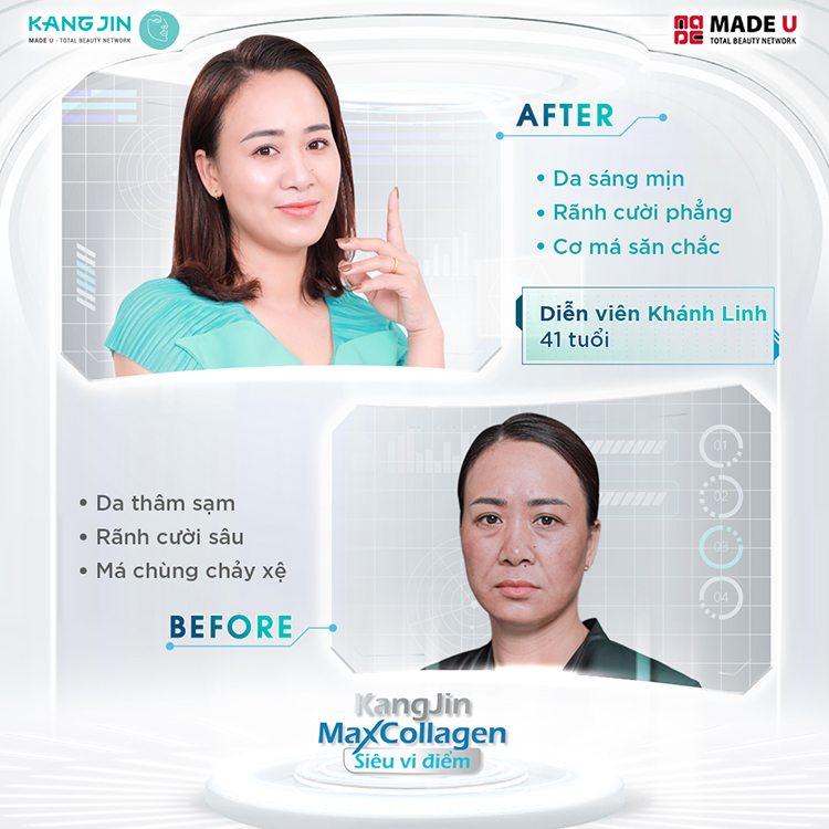 Da đẹp tức thì sau 60 phút trẻ hóa