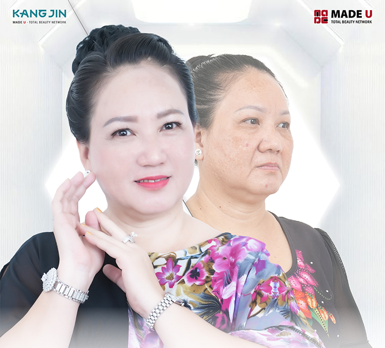  Cô Hà Thương đã nâng cấp làn da lão hóa, xóa sổ mọi nếp nhăn