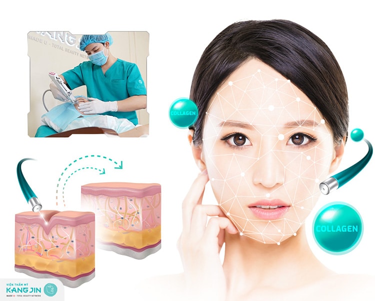 Sợi Collagen Nano Cell X6 giúp kích thích tăng sinh collagen tự nhiên gấp 6 lần 