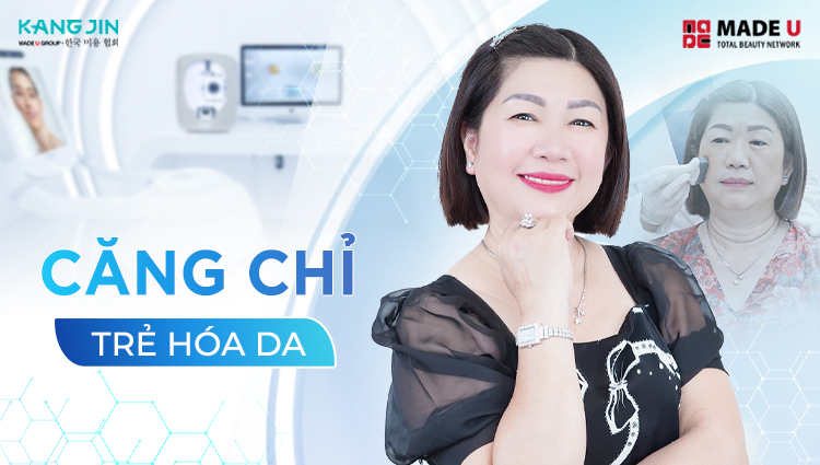 Căng chỉ thường mang lại kết quả sau khoảng 2 tháng