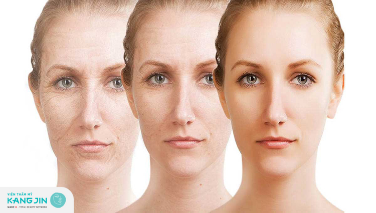 Chống lão hóa da mặt là một quá trình lâu dài và thường xuyên