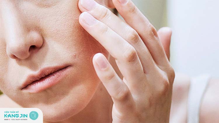 Rất nhiều dấu hiệu khiến da sần đỏ gây ngứa ngáy trên mặt 