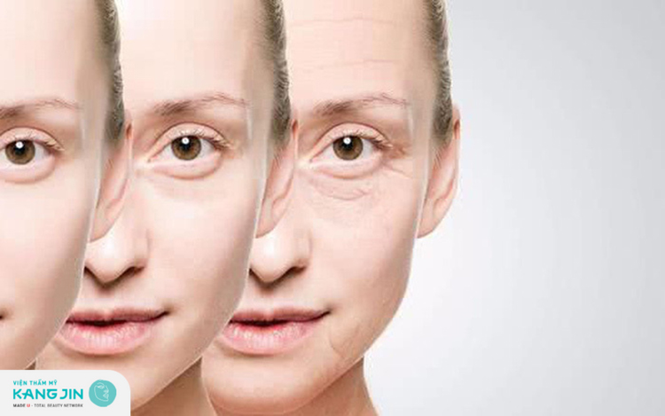 Da mặt ngày càng xuống sắc khi có nếp nhăn quanh mắt