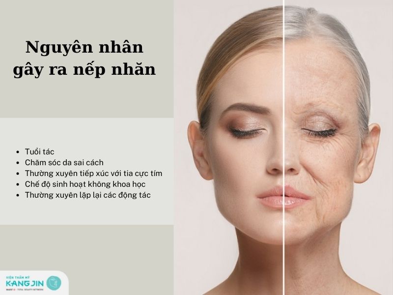 nếp nhăn hình thành do những nguyên nhân nào