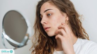 Da hỗn hợp thiên khô là gì? 5 Nguyên nhân và cách chăm sóc hiệu quả