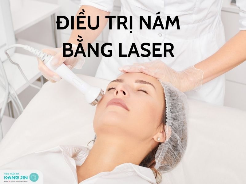 điều trị nám bằng phương pháp laser