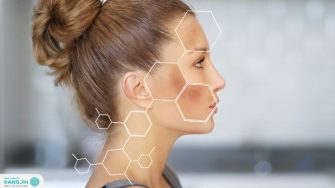 Các loại nám da phổ biến hiện nay | Cách nhận biết và phòng ngừa