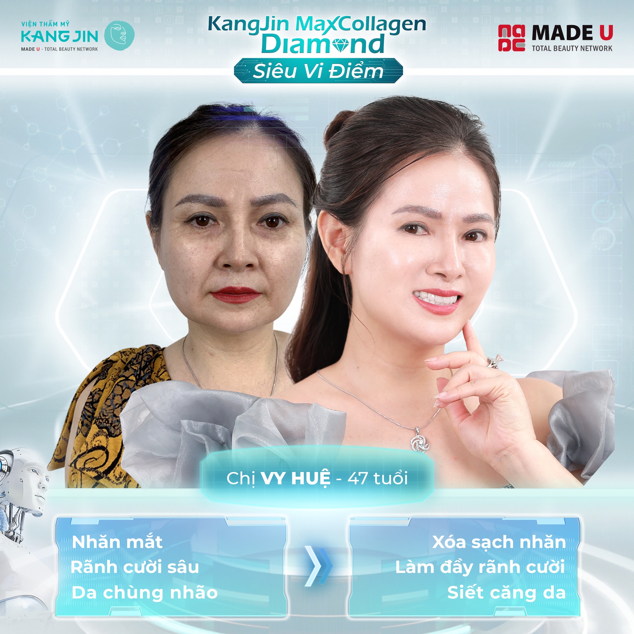 Chị Vy Huệ 