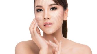 Căng chỉ nâng cơ mặt – Những điều cần biết trước khi thực hiện