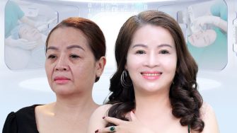 Lý do thực sự dẫn đến da mặt chảy xệ là gì, 5 giải pháp khắc phục tình trạng này