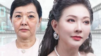 Bảng giá căng da mặt chảy xệ 2024 có gì đặc biệt và đáng chú ý?