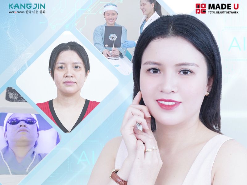 Hình ảnh khách hàng trước và sau khi thực hiện trẻ hóa da 