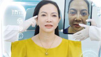 8 giải pháp nâng cơ mặt chảy xệ mới nhất và bảng giá chi phí 2024