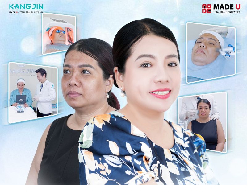 nâng cơ mặt