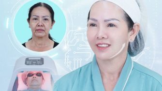 8 cách giải quyết chống lão hóa da mặt tốt nhất hiện nay