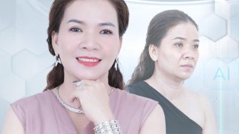 Xóa nếp nhăn trên mặt bao nhiêu tiền – Có đáng đầu tư không?
