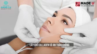 Cấy Chỉ Collagen Có An Toàn Không? Tìm Hiểu Chi Tiết Về Phương Pháp Làm Đẹp Hiện Đại