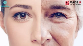 Mặt Già Trước Tuổi: Dấu Hiệu, Nguyên Nhân và Cách Khắc Phục