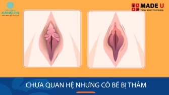 Tại sao vùng kín bị thâm khi chưa quan hệ? Nguyên nhân & Giải pháp trẻ hóa toàn diện