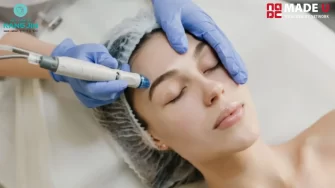 Cấy Collagen Tươi Giữ Được Bao Lâu? Có Thực Sự Tốt Cho Da?