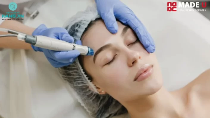 cấy collagen tươi giữ được bao lâu