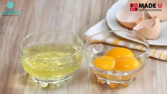 Trị nám bằng trứng gà – Bí quyết tự nhiên cho làn da sáng mịn